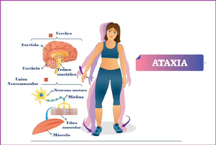 Ataxia En Ni Os Familia Y Salud   1550 Ataxia 